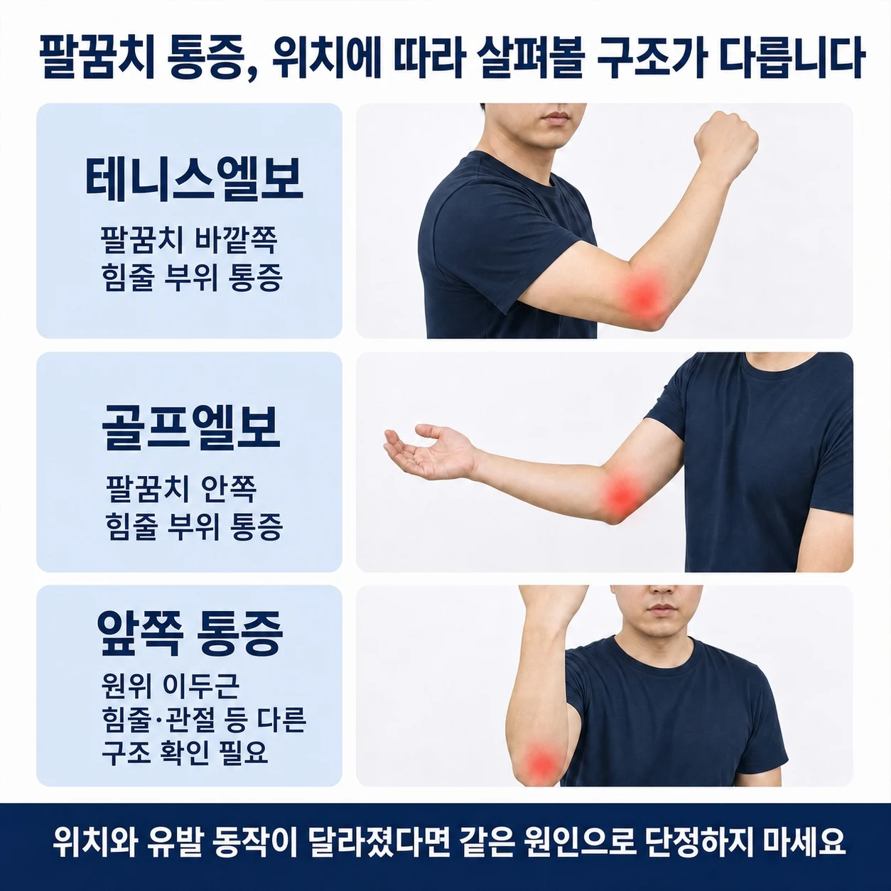 팔꿈치 통증 위치에 따른 구조 구분
