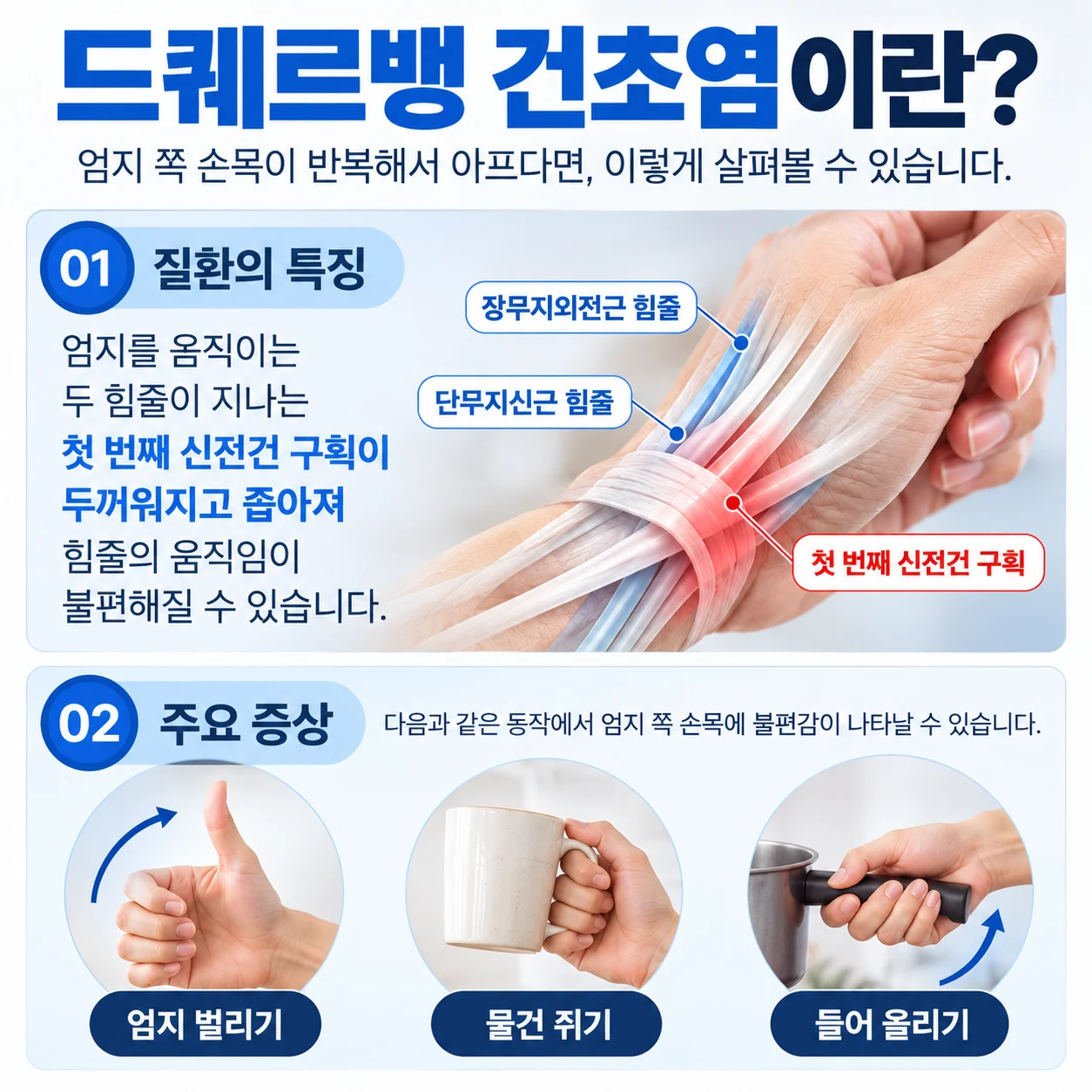 드퀘르벵 건초염과 엄지를 움직이는 힘줄